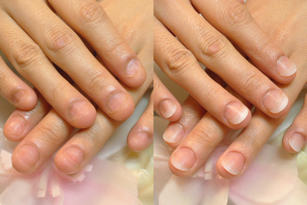 深爪矯正専門ネイルサロン Rifareリファーレ東京