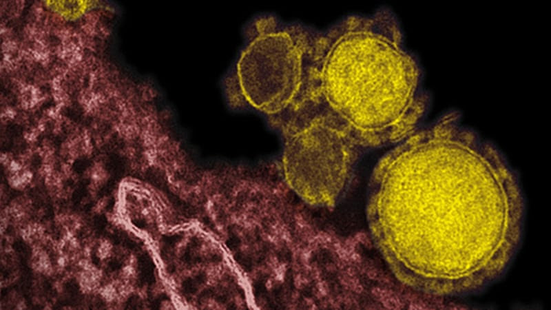 Thailand confirms first case of deadly MERS virus - Al Jazeera English