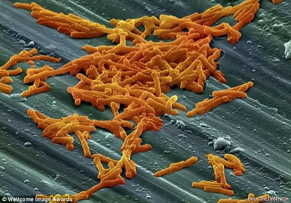 Vi khuẩn kháng thuốc kháng sinh đang trở thành một vấn nạn trên toàn thế giới.