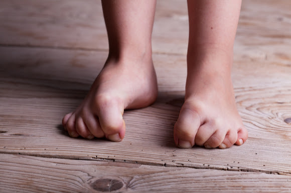 子供のしもやけは放っておくと大変 予防や対策 治し方をチェッ ク 子育て応援サイト March マーチ