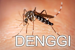 CARA RAWAT DEMAM DENGGI TANPA PERLU MAKAN UBAT DAN MINUM 