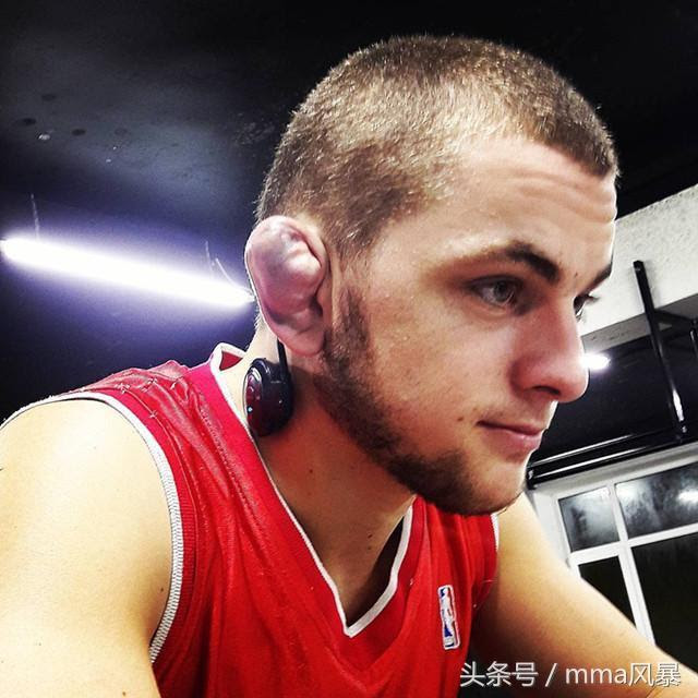 一定牢记 在街上看到这种耳朵的人最好别惹 这是很能打的象征 每日头条