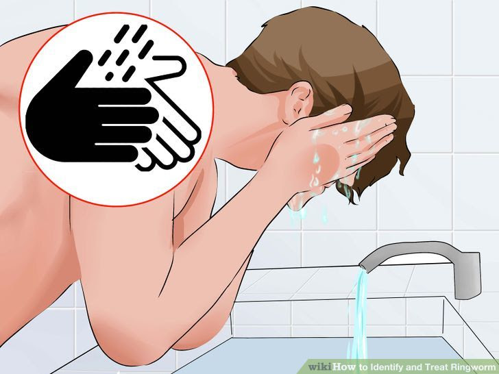 Identify and Treat Ringworm Step 18.jpg