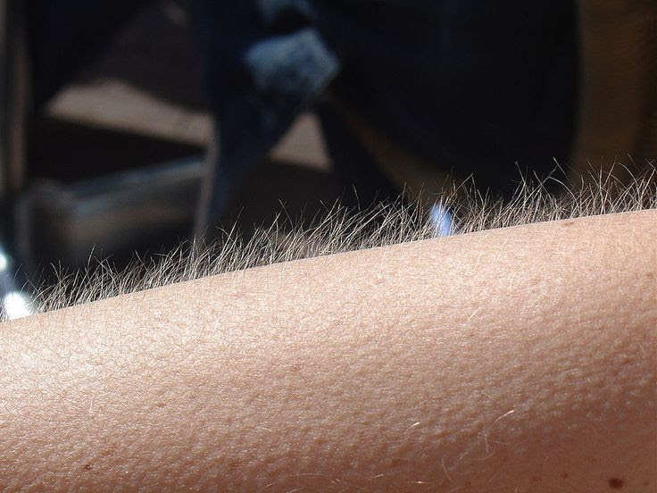 Goose bumps - עור ברוז - ויקימילון
