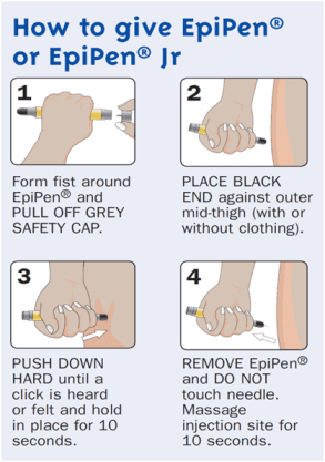 How_to_give_EpiPen