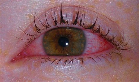 learning   run im baaaacckk