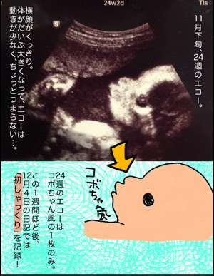 妊婦生活レポ21 エコー画像まとめ 24週 26週 28週 ちびお日記