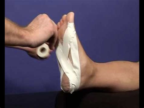 The pain occurs when the plantar fascia, the tissue that connects the heel bone to the toes, becomes weak or i. Taping technique for Plantar Fasciitis - YouTube