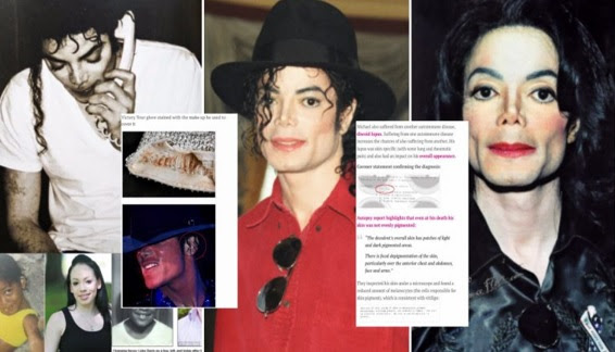 Adakah Ini Bukti Michael Jackson Sebenarnya Tak Buat Pembedahan Plastik Untuk Jadi ‘Orang Putih’?