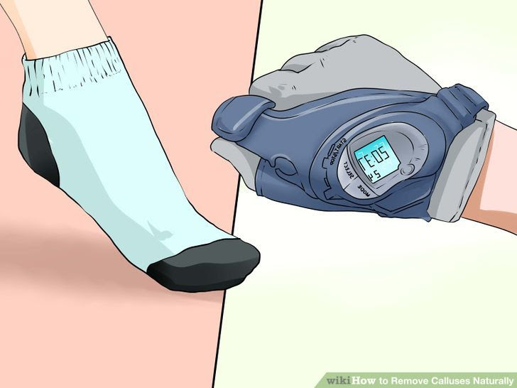 Remove Calluses Naturally Step 17 Version 2.jpg