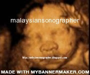 Banner created with MyBannerMaker.com