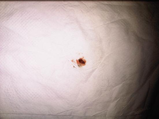 photo of bed bud killed on my hotel bed ( Nwadiuto O , set 2011)