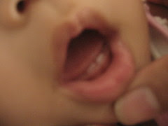 IMG_0285
