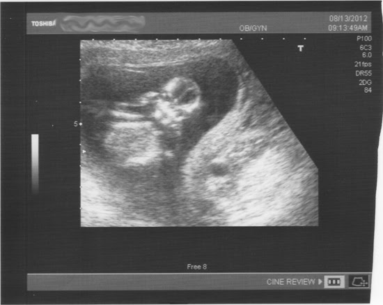 BabyJ_2_12BWeeks