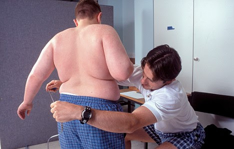 Obese child