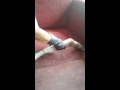 Lavagem de estofado