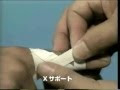無料ダウンロード 足 の 指 足 小指 骨折 テーピング 巻き 方 274955-足 の 指 足 小指 骨折 テーピング 巻き 方