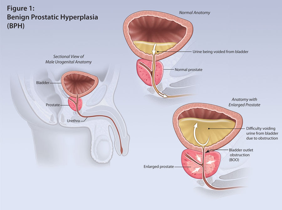 kidney characteristic mcq