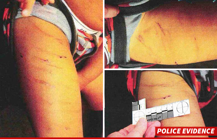 0912-adrian-peterson-son-injuries-03
