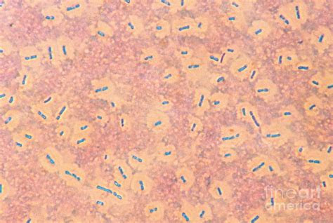 bacteria capsules photograph  eric  grave