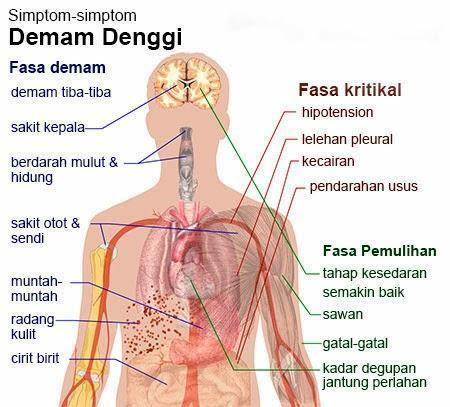 Tanda Demam Denggi dan Cara Rawatan  An-Nisa' Group