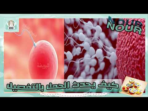 صورة