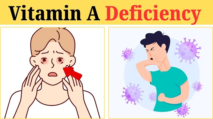 8 Warning Signs of Vitamin A Deficiency You Must Not Overlook