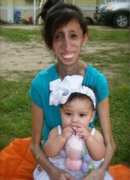 The Story of 21-year-old Lizzie Velasquez (17 pics) The Story of 21-year-old Lizzie Velasquez (17 pics)