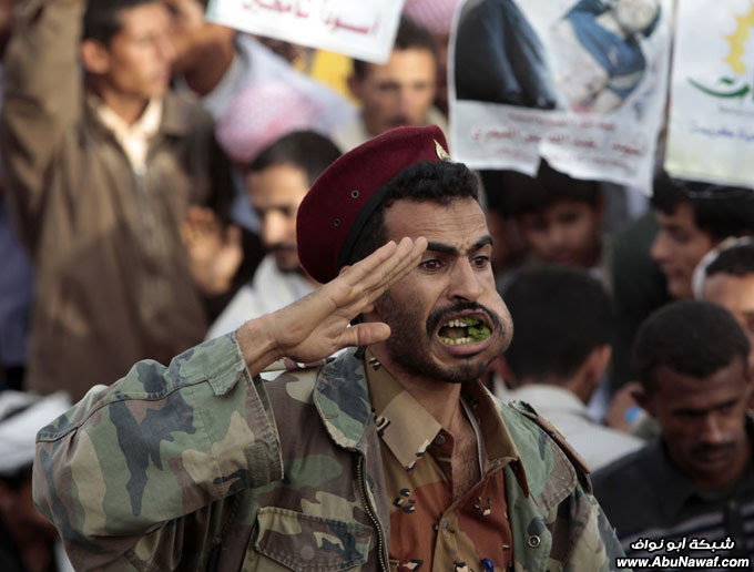 صور حول العالم: كابول فرايد تشيكن + حالة نادرة لطفل برأسين .. والمزيد