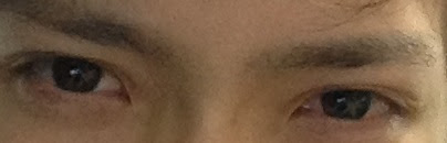 自力で二重にしたけど質問ある