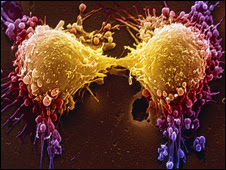 Cancer cell dividing, SPL