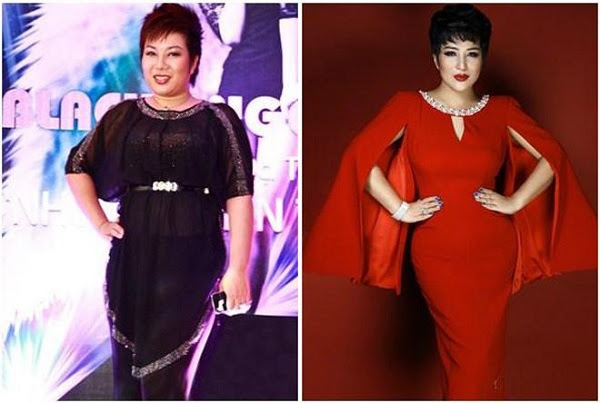nhung-ca-phau-thuat-tham-my-thanh-cong-nhat-9