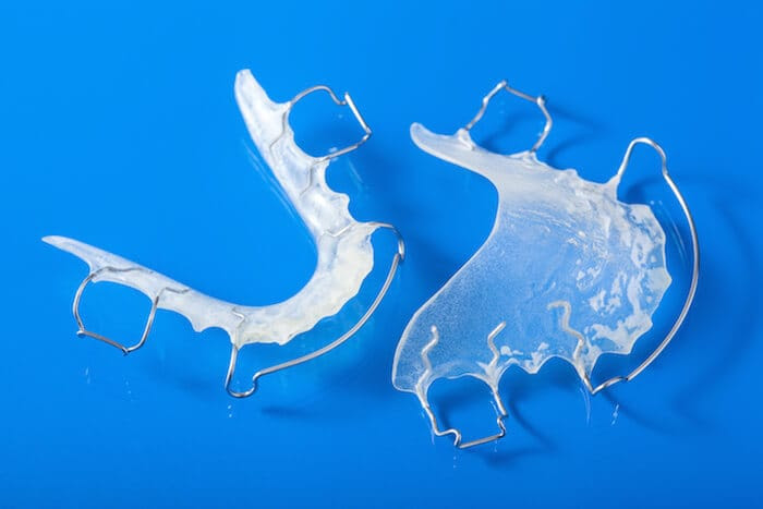 How long do you have a retainer 