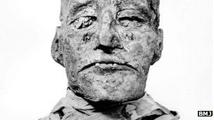 Luka sayatan ditemukan di leher mumi Firaun Ramses III .