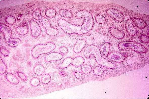 Testes Epididymis