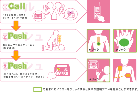 日本循環器学会 コール プッシュ誰でもできる胸骨圧迫 Aedの蘇生法