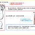 Osler Nodes and Janeway Lesions