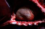 Rs virus voksne isolation