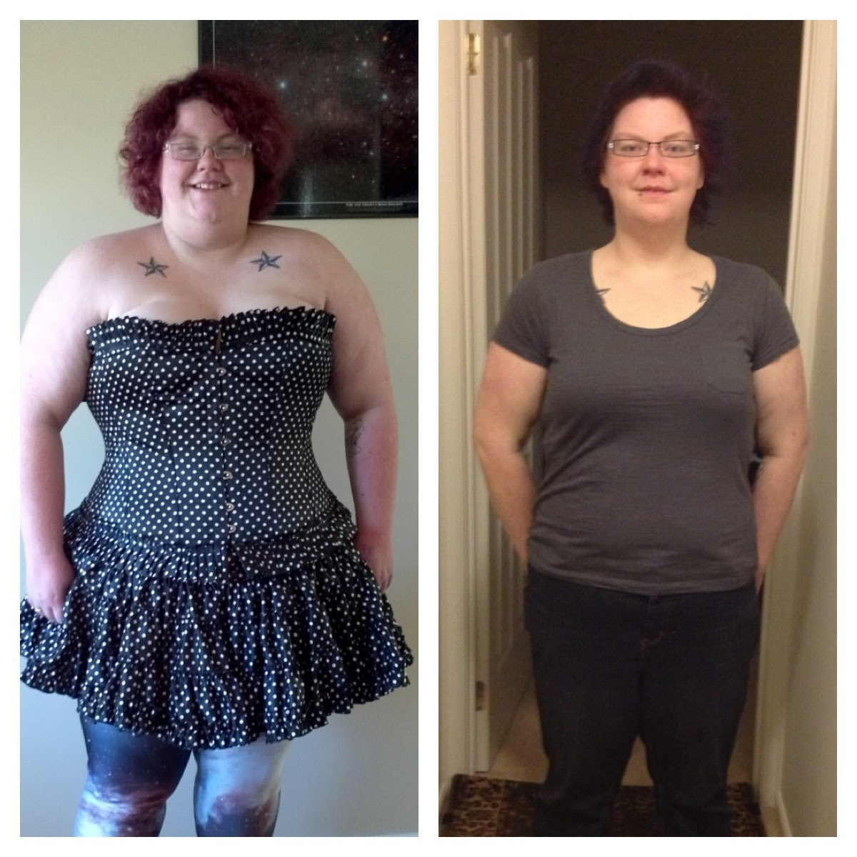 F/22/167cm [145kgs to 90kgs] (12 months) Lap band was the