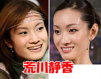 エラを整形した芸能人22選 女性17名 男性5名ランキング 画像付き 21最新版 Rank1 ランク1 人気ランキングまとめサイト 国内最大級