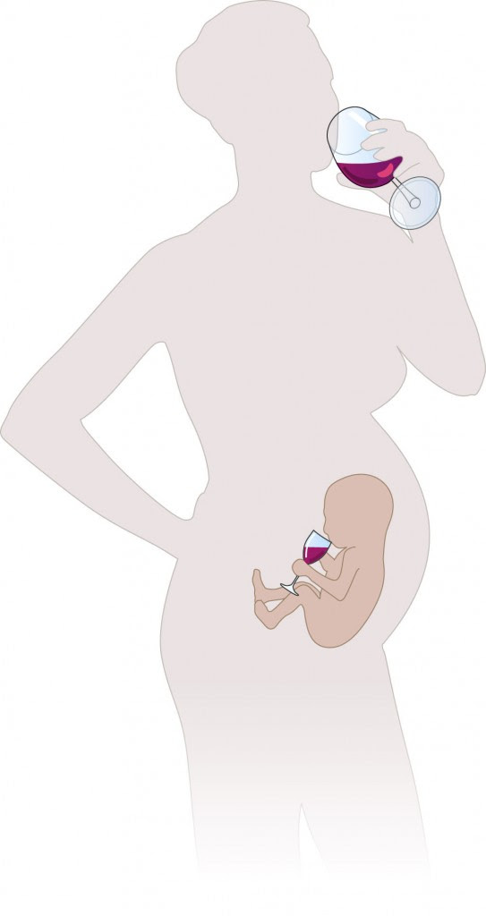 Understanding Fetal Alcohol Spectrum Disorders Fasd A Comprehensive Guide For Pre K 8 Educators
