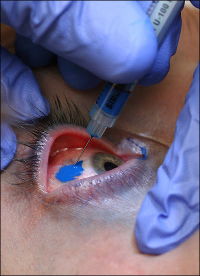 body-art fan's eye blue.