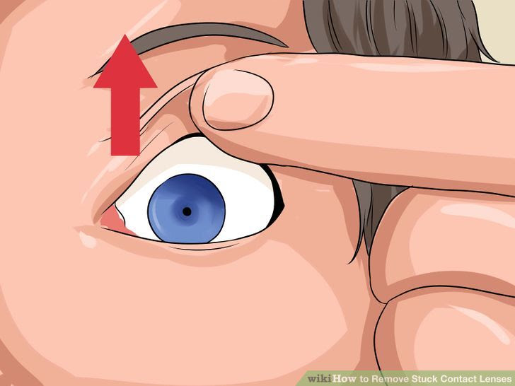 Remove Stuck Contact Lenses Step 3 Version 3.jpg