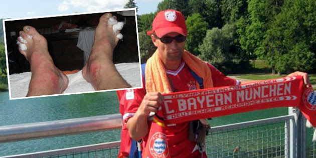 Vahid Čehaja and his heavily abused feet (enko-football.com)
