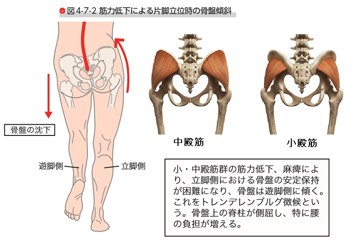 ランニングで酷使される中殿筋 小殿筋の働きを完全理解 逆ストレッチ ボールペンマッサージ