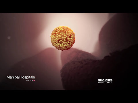 Youtube Procedure Of Cord Blood Transplant