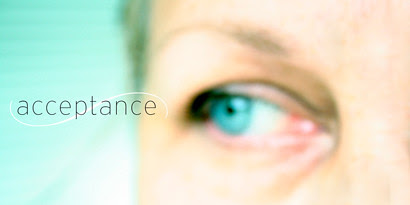acceptance410