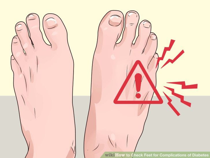 Check Feet for Complications of Diabetes Step 2 Version 2.jpg