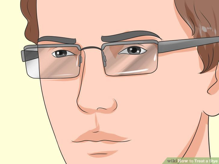 Treat a Stye Step 19 Version 2.jpg
