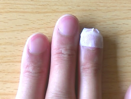 爪甲剥離症治療法 完治した私の治療法を全公開 爪甲剥離症 そうこうはくりしょう 治療ブログ